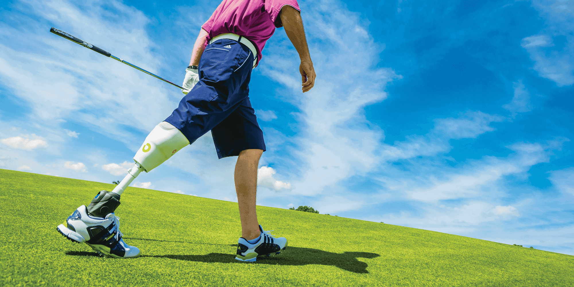 Man with Orthocare Prosthetic Playing Golf